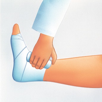 Schritt-für-Schritt Anleitung zum Anlegen eines Kompressionsverbandes