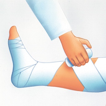 Schritt-für-Schritt Anleitung zum Anlegen eines Kompressionsverbandes