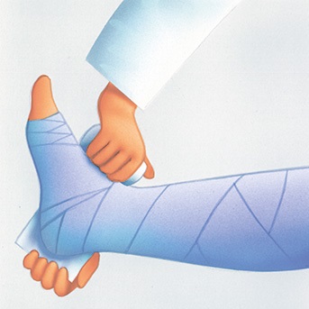 Schritt-für-Schritt Anleitung zum Anlegen eines Kompressionsverbandes