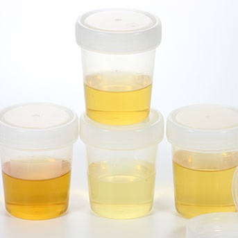 Abbildung von Urinproben