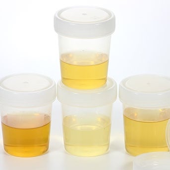 Abbildung von Urinproben