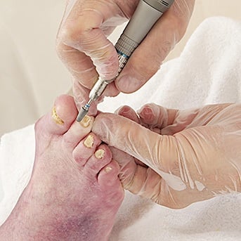 Fußpflege bei einem Diabetiker