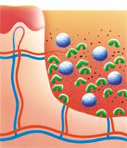 Darstellung der Regeneration einer infizierten Wunde in der Reinigungsphase