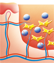 Darstellung der Regeneration einer Wunde in der Reinigungsphase