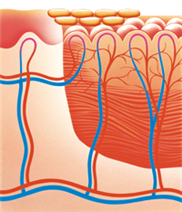 Darstellung der Regeneration einer Wunde in der fortgeschrittenen Epithelisierungsphase