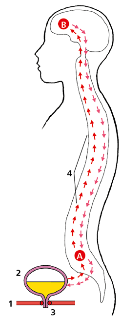 Darstellung einer Entleerungsstörung der Blase