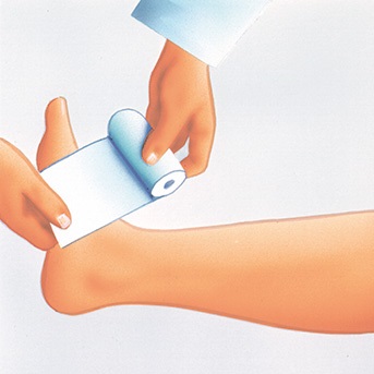 Schritt-für-Schritt Anleitung zum Anlegen eines Kompressionsverbandes