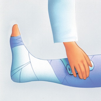 Schritt-für-Schritt Anleitung zum Anlegen eines Kompressionsverbandes