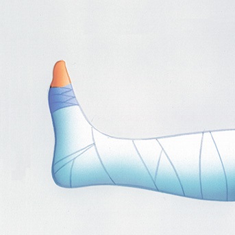 Schritt-für-Schritt Anleitung zum Anlegen eines Kompressionsverbandes