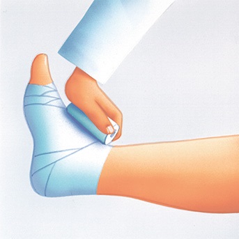 Schritt-für-Schritt Anleitung zum Anlegen eines Kompressionsverbandes