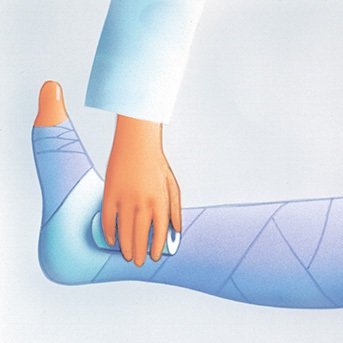 Schritt-für-Schritt Anleitung zum Anlegen eines Kompressionsverbandes