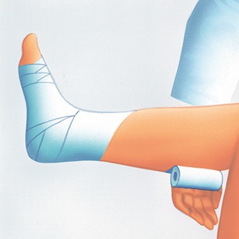 Schritt-für-Schritt Anleitung zum Anlegen eines Kompressionsverbandes