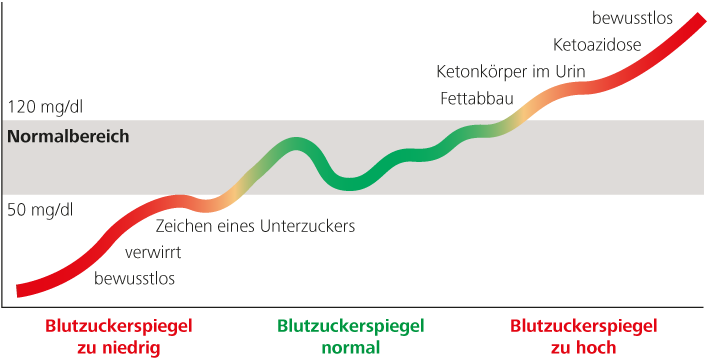 Graphik Blutzuckerwerte von Unterzucker bis Überzucker