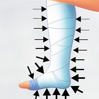 Darstellung des Druckverlaufs in einem Kompressionsverband