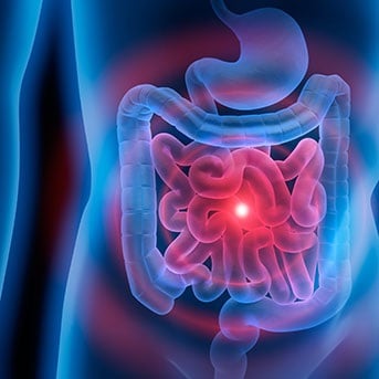 Darstellung des Darms