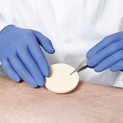 Wundversorgung mit steriler Wundauflage