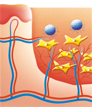 Darstellung der Regeneration einer Wunde in der Granulationsphase