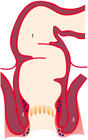 Darstellung der Darmentleerung
