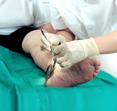 Durchführung eines Verbandwechsels am Bein