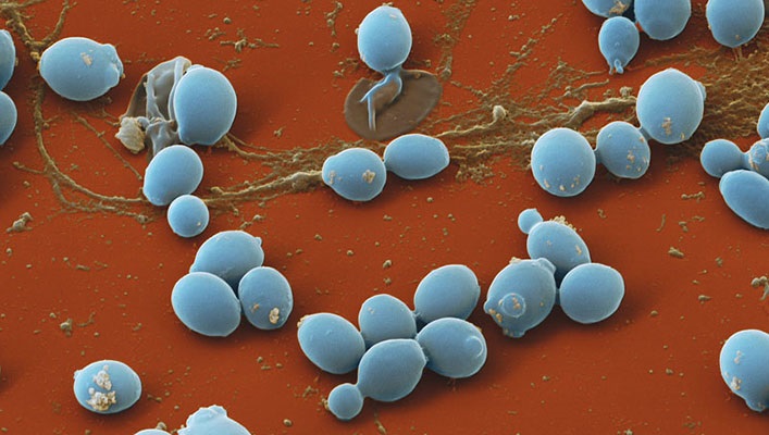 Krankmachende Bakterien Candida albicans unter dem Mikroskop