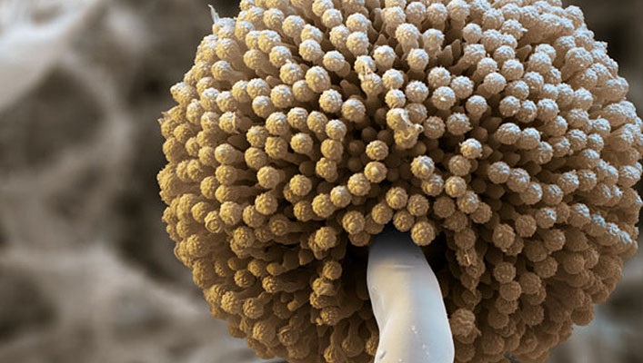 Krankheitserregender Pilz Aspergillus niger unter dem Mikroskop