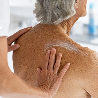 Rücken einer Seniorin wird eingecremt zur Pneumonieprophylaxe